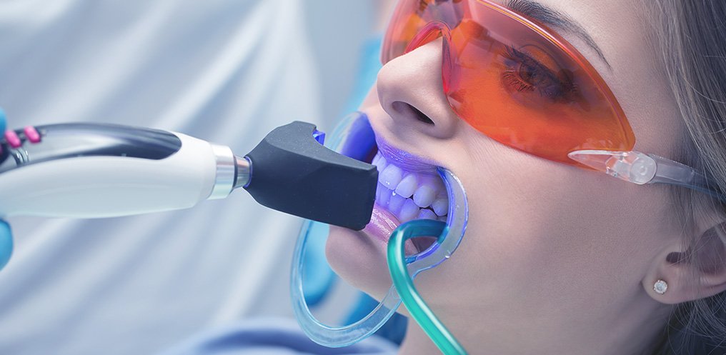 O que é Clareamento Dental? 