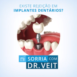 Existe rejeição em implantes dentários?