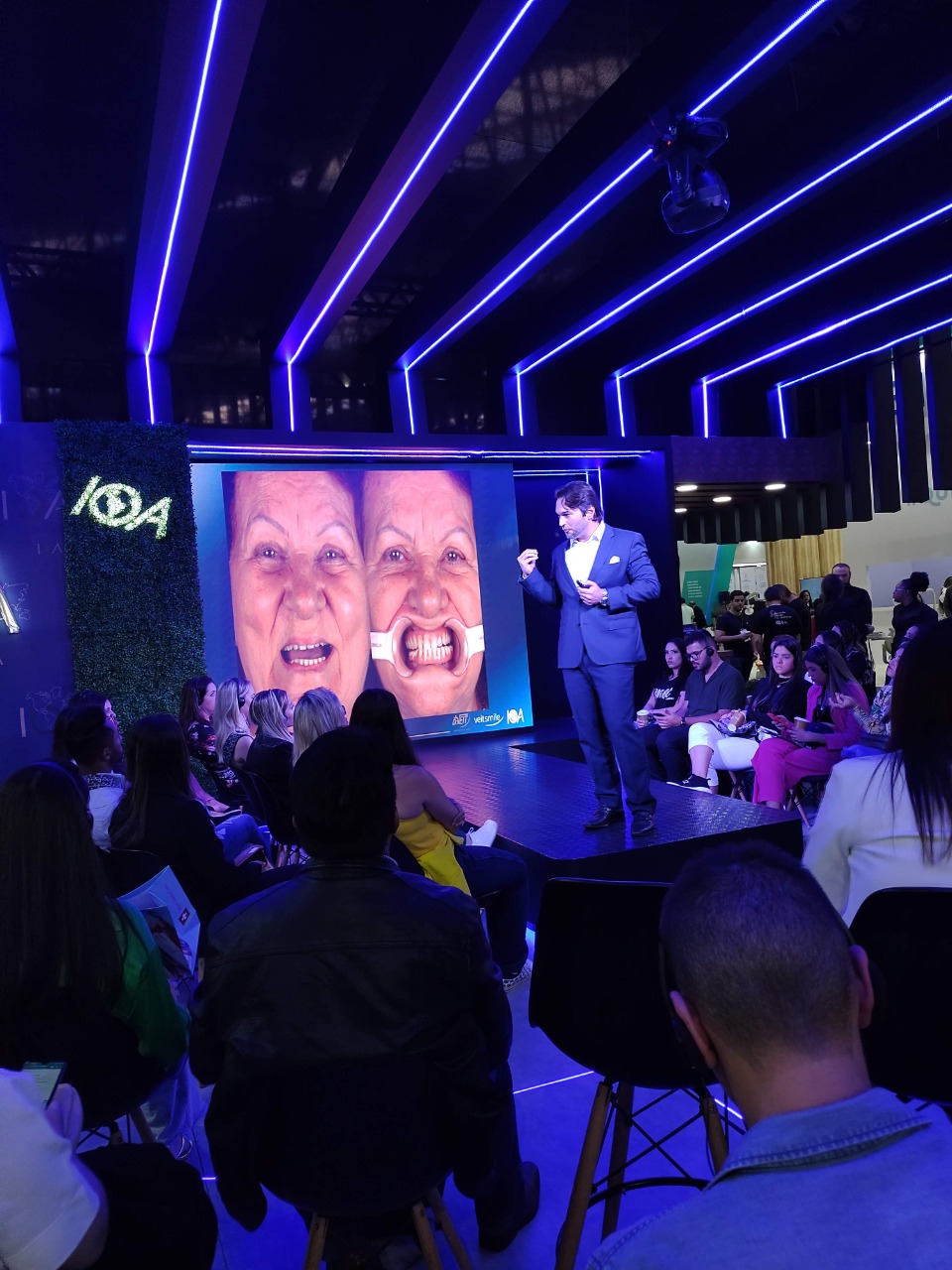 Implantes Zigomáticos - Carga Imediata