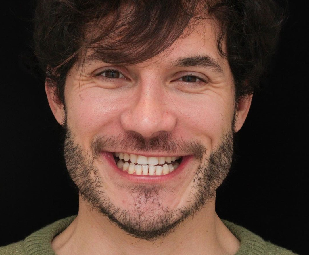 Eliezer antes e depois tratamento dentario