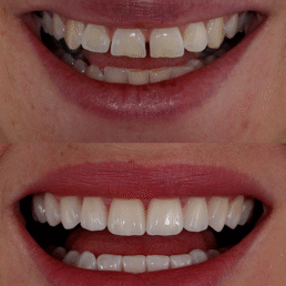 lente de contato no Jardim Europa