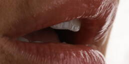 Lentes de contato dental na Vila Olímpia