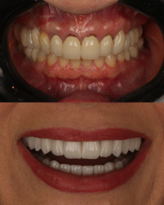 lentes de contato na Vila Olímpia