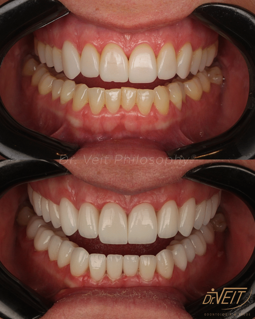 aparelho dental
