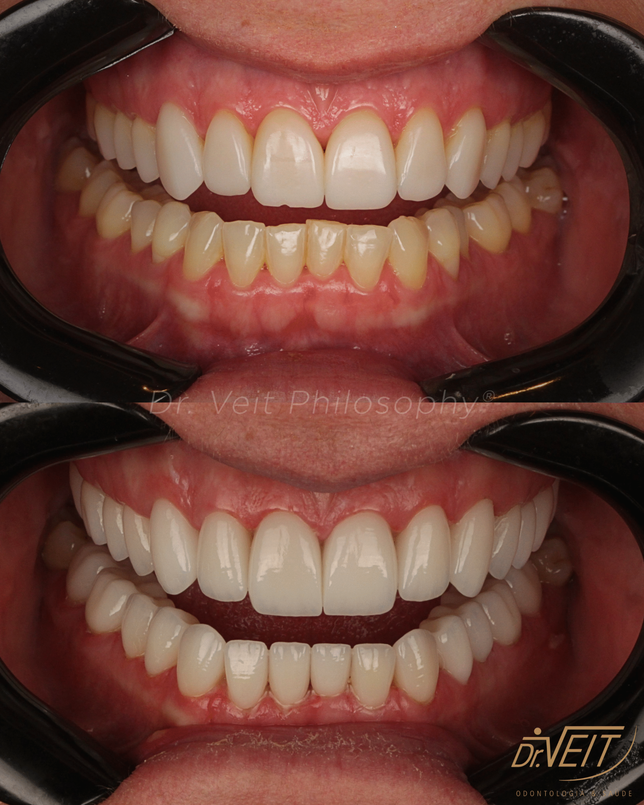 aparelho dental
