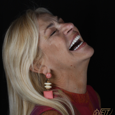 https_drveit.com.br_casos-clinicos_protocolo-de-zirconia-sobre-implantes-com-carga-imediata-11__9