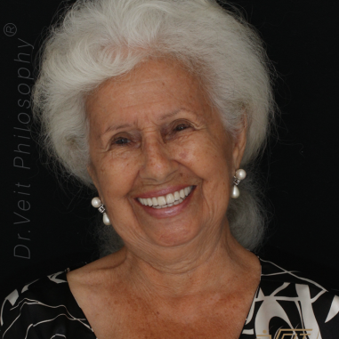 https_drveit.com.br_casos-clinicos_reabilitacao-oral-com-implantes-de-carga-imediata-10__11