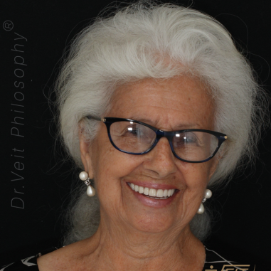 https_drveit.com.br_casos-clinicos_reabilitacao-oral-com-implantes-de-carga-imediata-10__3