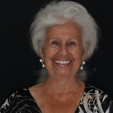 https_drveit.com.br_casos-clinicos_reabilitacao-oral-com-implantes-de-carga-imediata-10__7