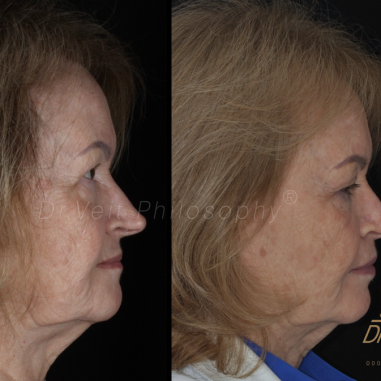 https_drveit.com.br_casos-clinicos_reabilitacao-oral-com-implantes-de-carga-imediata-15__2