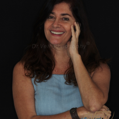 https_drveit.com.br_casos-clinicos_reabilitacao-oral-com-implantes-de-carga-imediata-3__8