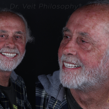 https_drveit.com.br_casos-clinicos_reabilitacao-oral-com-implantes-de-carga-imediata-5__3