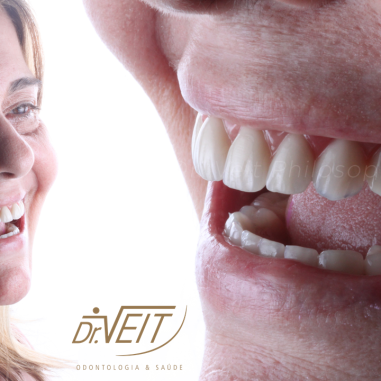 https_drveit.com.br_casos-clinicos_reabilitacao-oral-com-implantes-zigomaticos-13__5