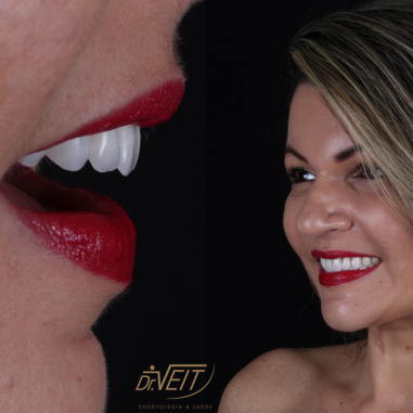 https_drveit.com.br_casos-clinicos_reabilitacao-oral-com-implantes-zigomaticos-14__7