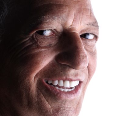 https_drveit.com.br_casos-clinicos_reabilitacao-oral-com-implantes-zigomaticos-15__4