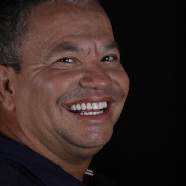 https_drveit.com.br_casos-clinicos_reabilitacao-oral-com-implantes-zigomaticos-6__2