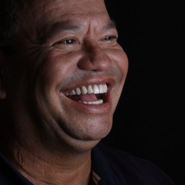 https_drveit.com.br_casos-clinicos_reabilitacao-oral-com-implantes-zigomaticos-6__5