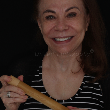 https_drveit.com.br_casos-clinicos_reabilitacao-oral-com-lentes-de-contato-8__6