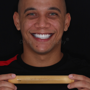 https_drveit.com.br_casos-clinicos_reabilitacao-oral-com-lentes-de-contato-9__9