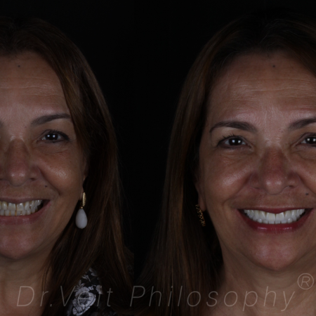 https_drveit.com.br_casos-clinicos_reabilitacao-oral-transdisciplinar-10__1