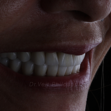 https_drveit.com.br_casos-clinicos_reabilitacao-oral-transdisciplinar-10__3