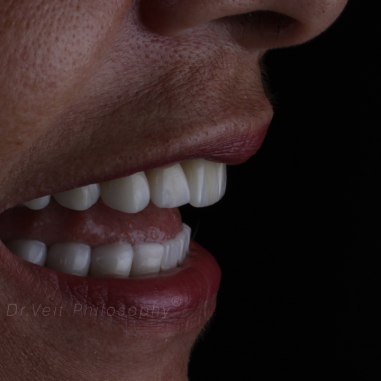 https_drveit.com.br_casos-clinicos_reabilitacao-oral-transdisciplinar-10__4