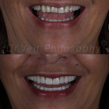 https_drveit.com.br_casos-clinicos_reabilitacao-oral-transdisciplinar-10__5