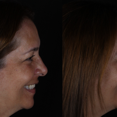 https_drveit.com.br_casos-clinicos_reabilitacao-oral-transdisciplinar-10__6