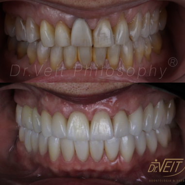 https_drveit.com.br_casos-clinicos_reabilitacao-oral-transdisciplinar-10__9