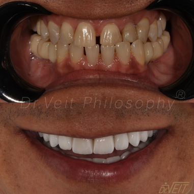 https_drveit.com.br_casos-clinicos_reabilitacao-oral-transdisciplinar-12__4