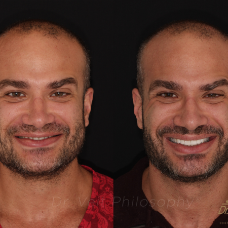 https_drveit.com.br_casos-clinicos_reabilitacao-oral-transdisciplinar-13__1