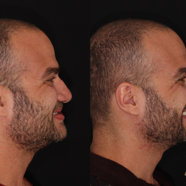 https_drveit.com.br_casos-clinicos_reabilitacao-oral-transdisciplinar-13__5