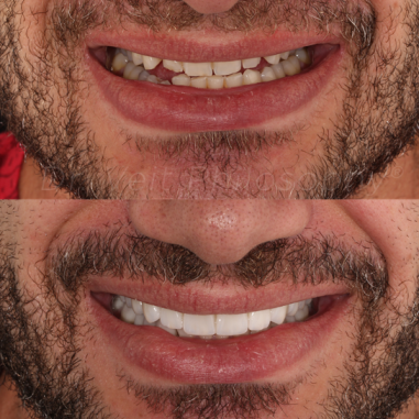 https_drveit.com.br_casos-clinicos_reabilitacao-oral-transdisciplinar-13__6