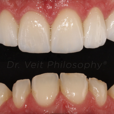 https_drveit.com.br_casos-clinicos_reabilitacao-oral-transdisciplinar-13__8