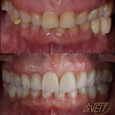 https_drveit.com.br_casos-clinicos_reabilitacao-oral-transdisciplinar-14__10