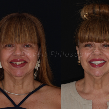 https_drveit.com.br_casos-clinicos_reabilitacao-oral-transdisciplinar-14__12