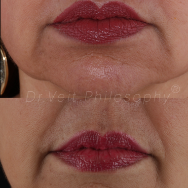 https_drveit.com.br_casos-clinicos_reabilitacao-oral-transdisciplinar-14__13