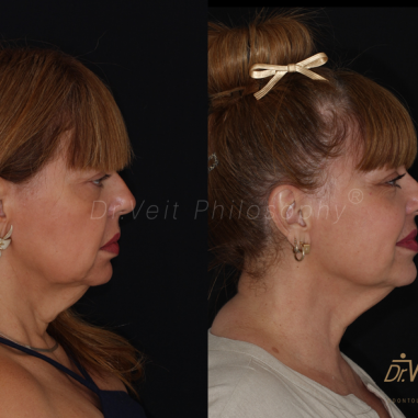 https_drveit.com.br_casos-clinicos_reabilitacao-oral-transdisciplinar-14__14