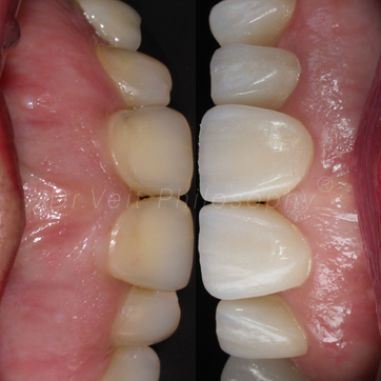 https_drveit.com.br_casos-clinicos_reabilitacao-oral-transdisciplinar-14__15