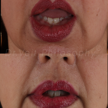 https_drveit.com.br_casos-clinicos_reabilitacao-oral-transdisciplinar-14__16