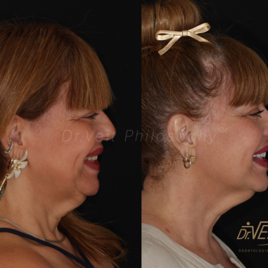 https_drveit.com.br_casos-clinicos_reabilitacao-oral-transdisciplinar-14__2