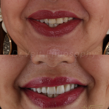 https_drveit.com.br_casos-clinicos_reabilitacao-oral-transdisciplinar-14__3