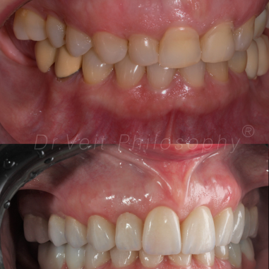 https_drveit.com.br_casos-clinicos_reabilitacao-oral-transdisciplinar-14__4