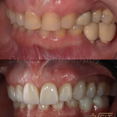 https_drveit.com.br_casos-clinicos_reabilitacao-oral-transdisciplinar-14__5