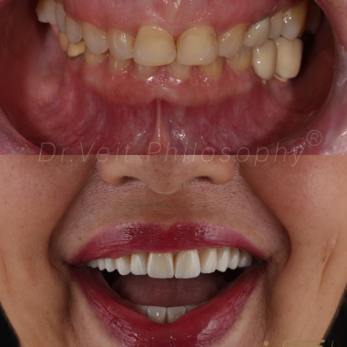 https_drveit.com.br_casos-clinicos_reabilitacao-oral-transdisciplinar-14__6