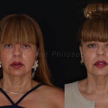 https_drveit.com.br_casos-clinicos_reabilitacao-oral-transdisciplinar-14__7