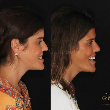 https_drveit.com.br_casos-clinicos_reabilitacao-oral-transdisciplinar-16__10