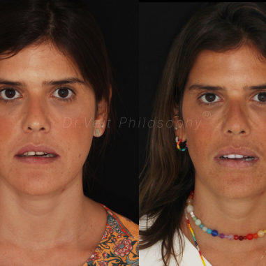 https_drveit.com.br_casos-clinicos_reabilitacao-oral-transdisciplinar-16__12