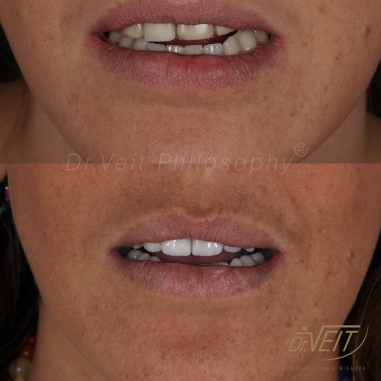 https_drveit.com.br_casos-clinicos_reabilitacao-oral-transdisciplinar-16__13