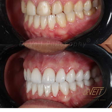 https_drveit.com.br_casos-clinicos_reabilitacao-oral-transdisciplinar-16__17